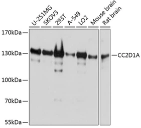 Anti-CC2D1A antibody used in Western Blot (WB). GTX64877