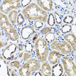 Anti-CC2D1A antibody used in IHC (Paraffin sections) (IHC-P). GTX64877