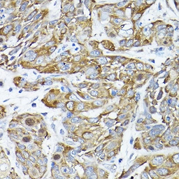 Anti-CC2D1A antibody used in IHC (Paraffin sections) (IHC-P). GTX64877