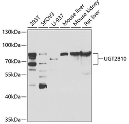 Anti-UGT2B10 antibody used in Western Blot (WB). GTX64878