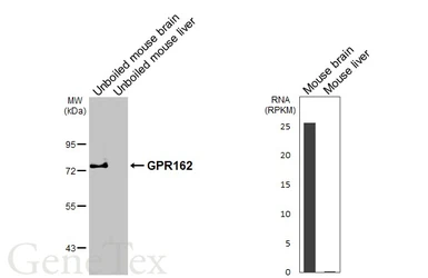 Anti-GPR162 antibody [HL6359] used in Western Blot (WB). GTX648798