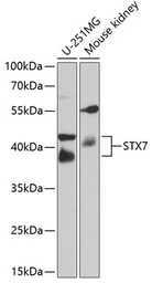 Anti-Syntaxin 7 antibody used in Western Blot (WB). GTX64880
