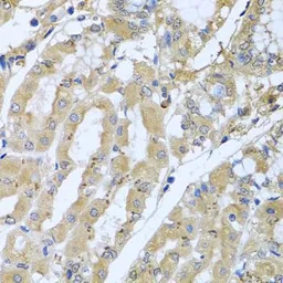Anti-Syntaxin 7 antibody used in IHC (Paraffin sections) (IHC-P). GTX64880