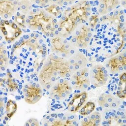 Anti-Syntaxin 7 antibody used in IHC (Paraffin sections) (IHC-P). GTX64880