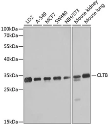 Anti-CLTB antibody used in Western Blot (WB). GTX64881