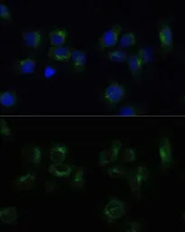 Anti-CLTB antibody used in Immunocytochemistry/ Immunofluorescence (ICC/IF). GTX64881