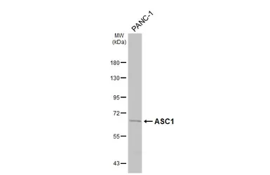 Anti-ASC1 antibody [HL6371] used in Western Blot (WB). GTX648810