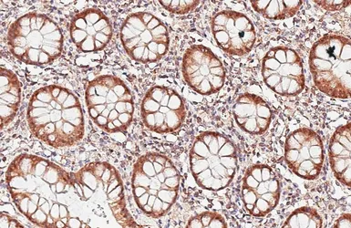 Anti-ASC1 antibody [HL6371] used in IHC (Paraffin sections) (IHC-P). GTX648810