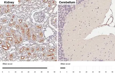 Anti-ACE antibody [HL6377] used in IHC (Paraffin sections) (IHC-P). GTX648816