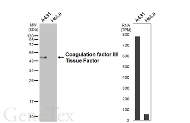 Anti-Coagulation factor III/Tissue Factor antibody [HL6378] used in Western Blot (WB). GTX648817