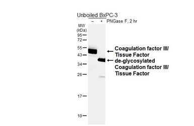 Anti-Coagulation factor III/Tissue Factor antibody [HL6378] used in Western Blot (WB). GTX648817