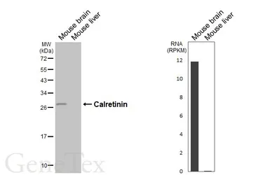 Anti-Calretinin antibody [HL6379] used in Western Blot (WB). GTX648818