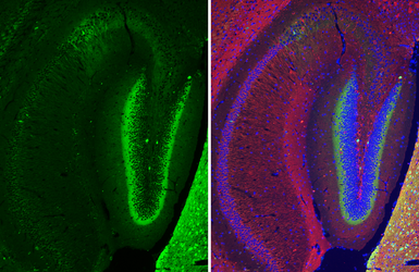 Anti-Calretinin antibody [HL6380] used in IHC (Paraffin sections) (IHC-P). GTX648819