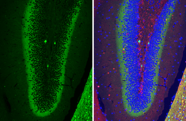Anti-Calretinin antibody [HL6380] used in IHC (Paraffin sections) (IHC-P). GTX648819