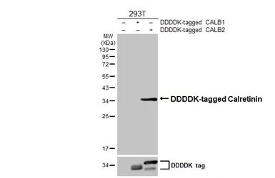 Anti-Calretinin antibody [HL6380] used in Western Blot (WB). GTX648819