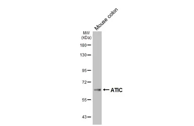Anti-ATIC antibody [HL6383] used in Western Blot (WB). GTX648822
