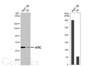 Anti-ATIC antibody [HL6383] used in Western Blot (WB). GTX648822
