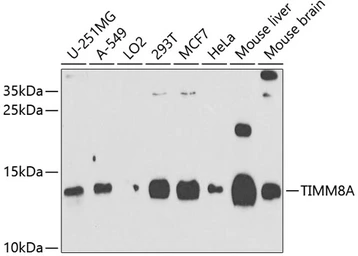 Anti-TIMM8A antibody used in Western Blot (WB). GTX64883
