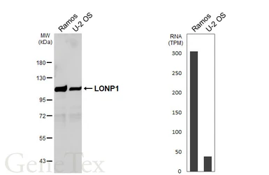 Anti-LONP1 antibody [HL6394] used in Western Blot (WB). GTX648833