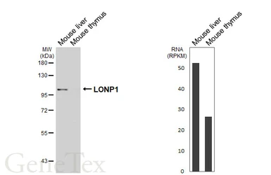 Anti-LONP1 antibody [HL6394] used in Western Blot (WB). GTX648833