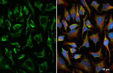 Anti-LONP1 antibody [HL6394] used in Immunocytochemistry/ Immunofluorescence (ICC/IF). GTX648833