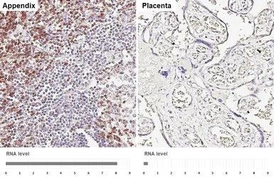 Anti-CD3 delta antibody [GT415] used in IHC (Paraffin sections) (IHC-P). GTX648838