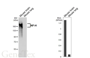 Anti-NF-H antibody [HL6395] used in Western Blot (WB). GTX648840