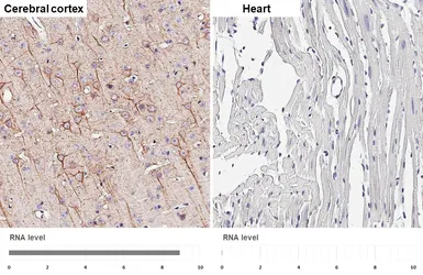 Anti-NF-H antibody [HL6395] used in IHC (Paraffin sections) (IHC-P). GTX648840