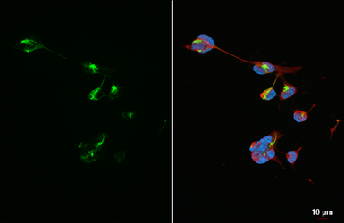 Anti-NF-H antibody [HL6395] used in Immunocytochemistry/ Immunofluorescence (ICC/IF). GTX648840