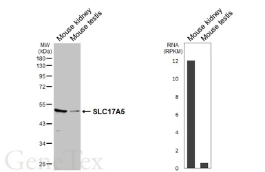 Anti-SLC17A5 antibody [HL6399] used in Western Blot (WB). GTX648844