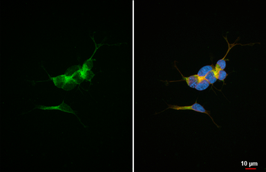Anti-ALK antibody [HL6409] used in Immunocytochemistry/ Immunofluorescence (ICC/IF). GTX648854
