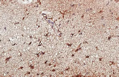 Anti-ALK antibody [HL6409] used in IHC (Paraffin sections) (IHC-P). GTX648854