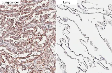 Anti-ALK antibody [HL6409] used in IHC (Paraffin sections) (IHC-P). GTX648854