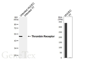 Anti-Thrombin Receptor antibody [HL6410] used in Western Blot (WB). GTX648855