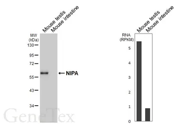 Anti-NIPA antibody [HL6411] used in Western Blot (WB). GTX648856