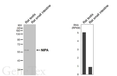 Anti-NIPA antibody [HL6411] used in Western Blot (WB). GTX648856