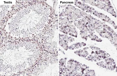 Anti-NIPA antibody [HL6411] used in IHC (Paraffin sections) (IHC-P). GTX648856