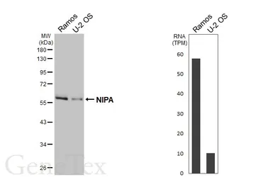 Anti-NIPA antibody [HL6411] used in Western Blot (WB). GTX648856
