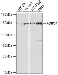 Anti-Robo4 antibody used in Western Blot (WB). GTX64886