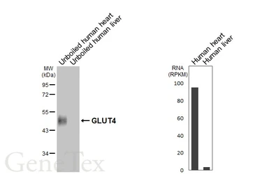 Anti-GLUT4 antibody [HL6419] used in Western Blot (WB). GTX648864