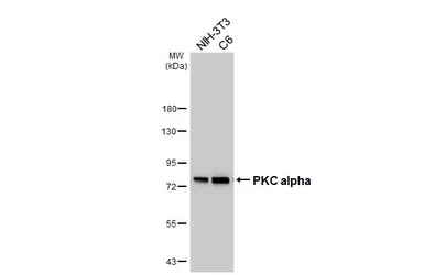 Anti-PKC alpha antibody [HL6427] used in Western Blot (WB). GTX648872
