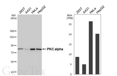 Anti-PKC alpha antibody [HL6427] used in Western Blot (WB). GTX648872