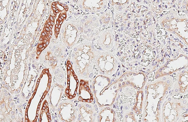 Anti-PKC alpha antibody [HL6427] used in IHC (Paraffin sections) (IHC-P). GTX648872