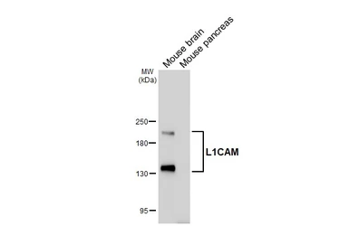 Anti-L1CAM antibody [HL6436] used in Western Blot (WB). GTX648881
