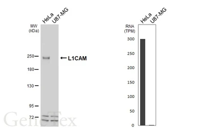 Anti-L1CAM antibody [HL6436] used in Western Blot (WB). GTX648881