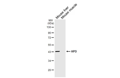 Anti-HPD antibody [HL6437] used in Western Blot (WB). GTX648882