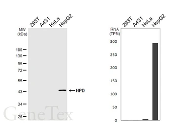 Anti-HPD antibody [HL6437] used in Western Blot (WB). GTX648882
