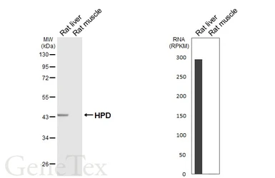 Anti-HPD antibody [HL6437] used in Western Blot (WB). GTX648882
