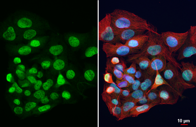 Anti-HPD antibody [HL6438] used in Immunocytochemistry/ Immunofluorescence (ICC/IF). GTX648883
