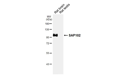 Anti-SAP102 antibody [HL6440] used in Western Blot (WB). GTX648888